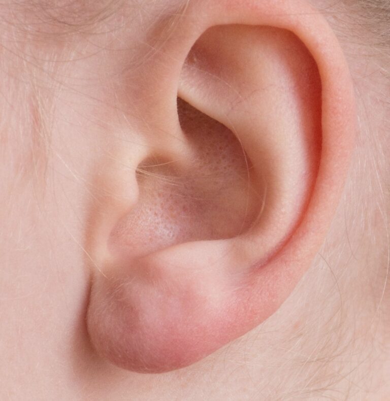 Oreille