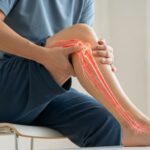 Quelle est la signification de la sciatique jambe gauche : la compression du nerf sciatique